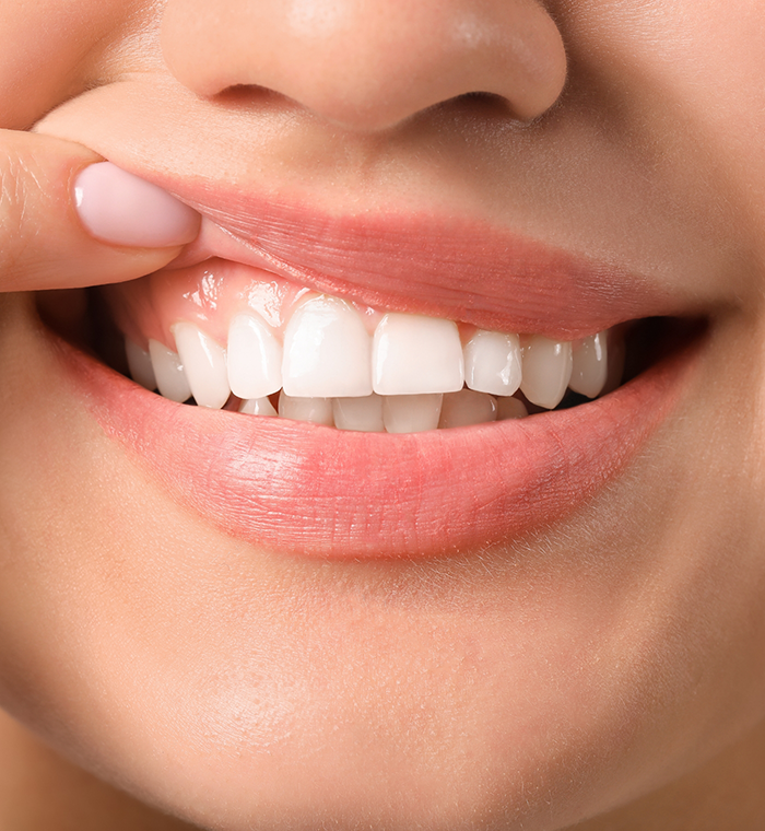 Pulling up lips to show gums