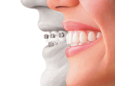 The image features a split-screen comparison of a person s face with a dental implant on one side and without on the other, highlighting the difference in appearance.