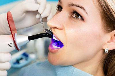 An individual receiving dental care with a purple mouthpiece, assisted by a dental professional using a device to clean teeth.