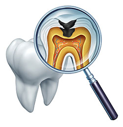 The image features a magnified view of a tooth with an open crown, showing the interior structure including the pulp chamber filled with fluid and tissue, viewed through a magnifying glass with an X-ray film background.