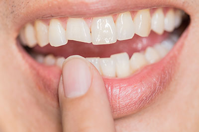 The image shows a close-up of a person s mouth with teeth being brushed, featuring an electric toothbrush and toothpaste foam.