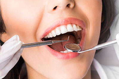 A woman with open mouth wearing dental tools while smiling.