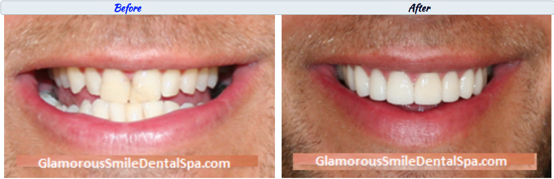 Glamorous Smile Dental Spa|Oral Health Consultation