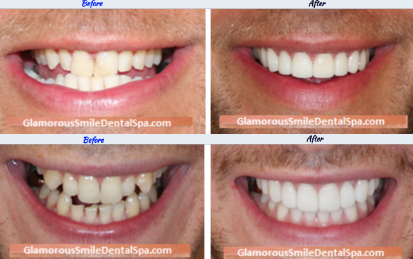 Glamorous Smile Dental Spa|Smile Gallery